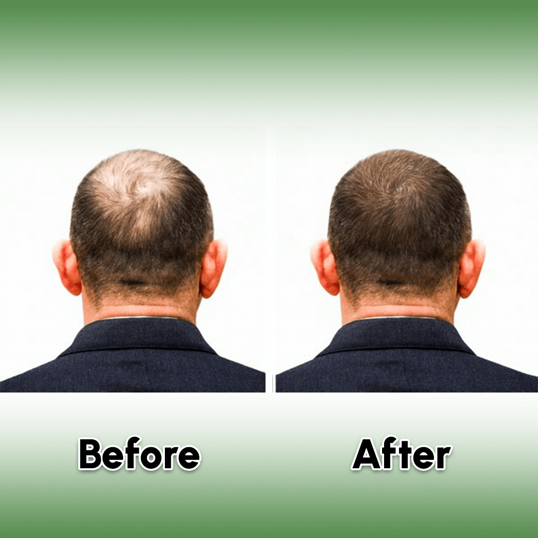 Zaibella 15 Natural Herbs Hair Oil