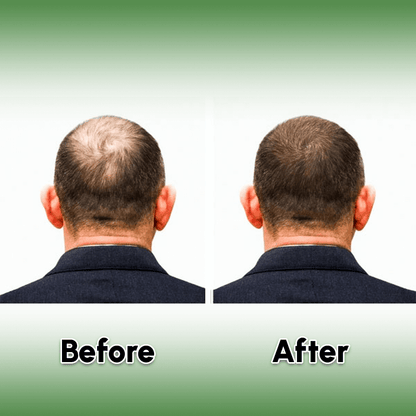 Zaibella 15 Natural Herbs Hair Oil